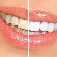 Colgate Total 12 – на страже здоровой улыбки